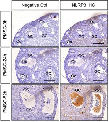 Expression and Contribution of NLRP3 Inflammasome During the Follicular Development Induced by PMSG